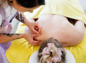 Therapist applying dry needles clients shoulder in a massage room