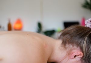 Female lying on front with acupuncture needles in shoulder