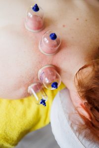 Female client lying face down with suction cups on shoulder