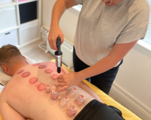 Therapist applying cupping therapy to clients back