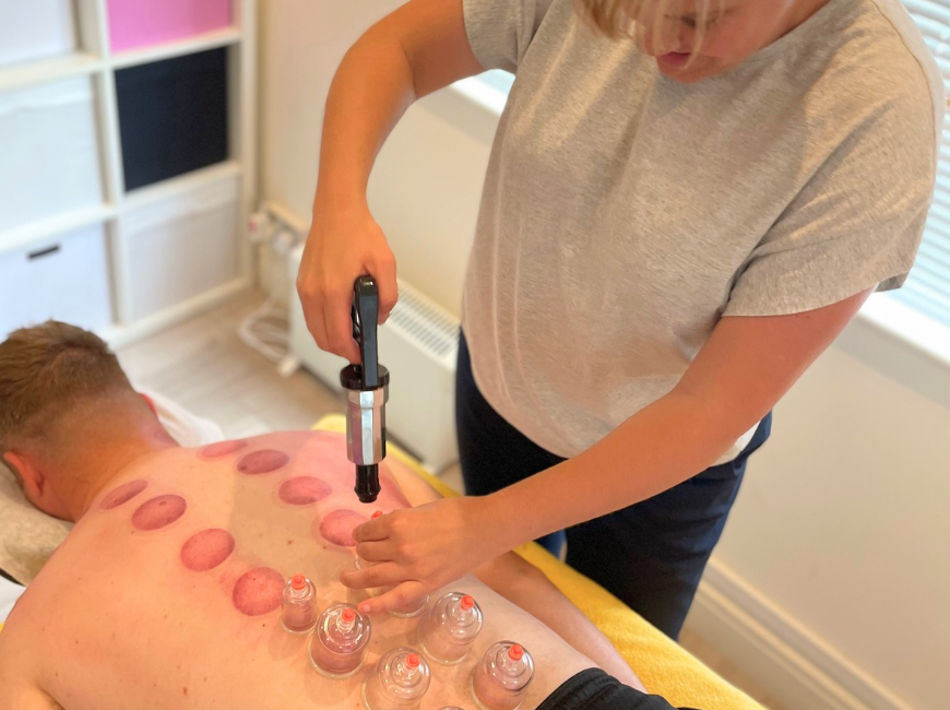 Therapist applying cups to clients back